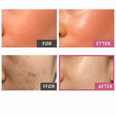 ™KOEC Pink Peptide Collagen Capsule Cream